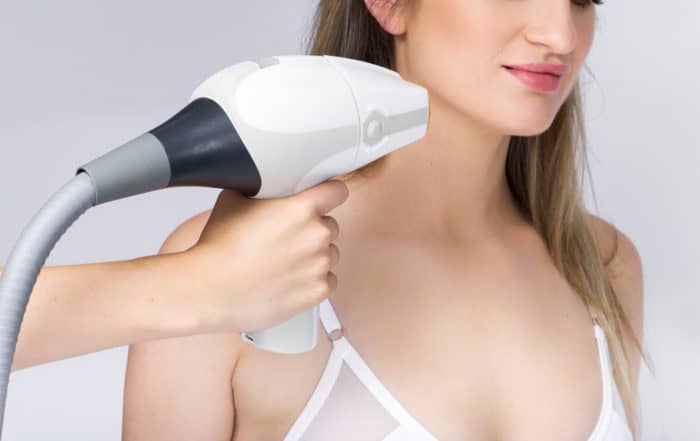 laser hair removal face