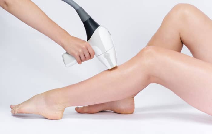 pre laser hair removal image