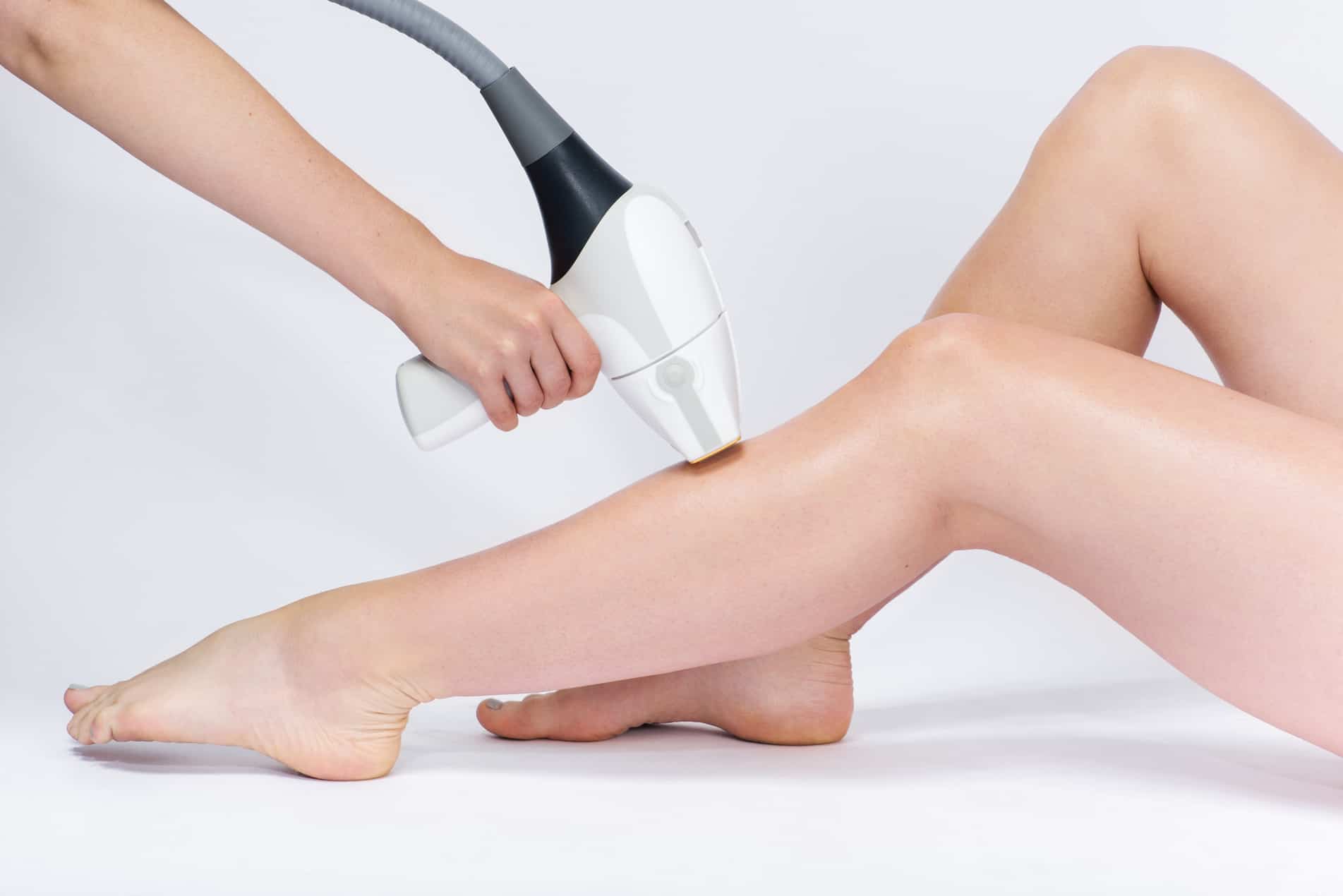 pre laser hair removal image